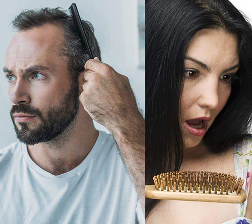Haarausfall bei Männern und bei Frauen